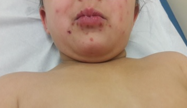 Picture1